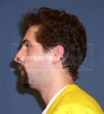 Andrew Feyereisen