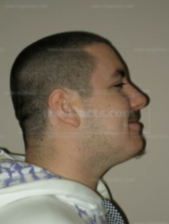 Jason J Incandela