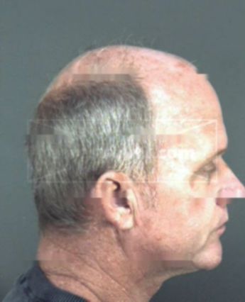 Thomas Doyle Robinette