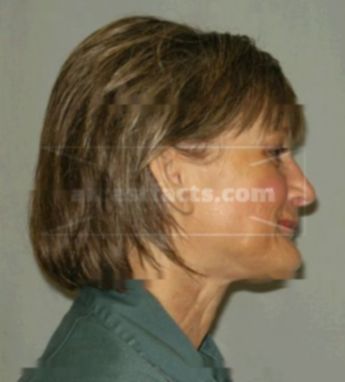 Wilhelmina Ann Shumway