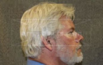 James T Thompson