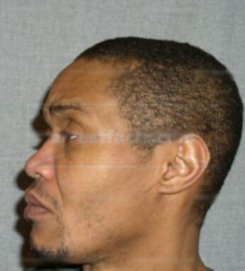 Derrick L Richards