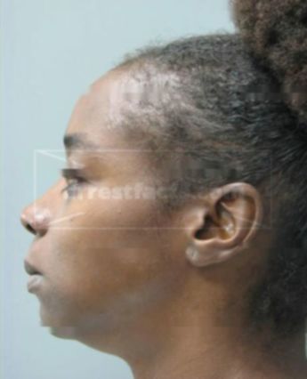 Mantrell Killian