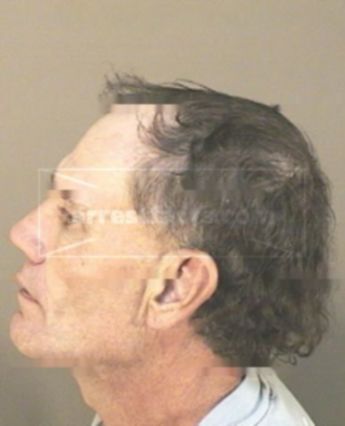 Dennis Grady Worley