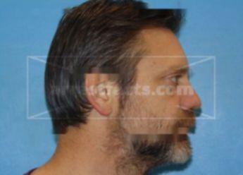 Timothy Alan Morse