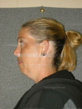 Nichole D Borchardt