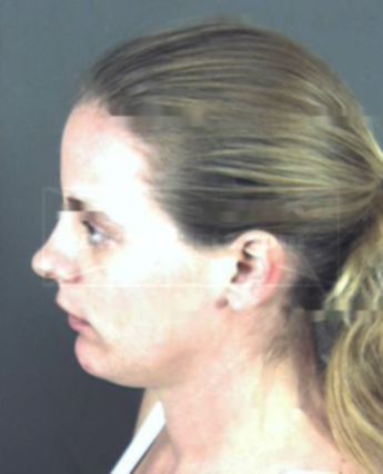 Patricia Sue Gosnell