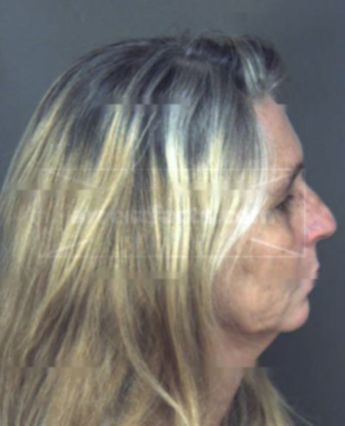 Connie Lynn Moore