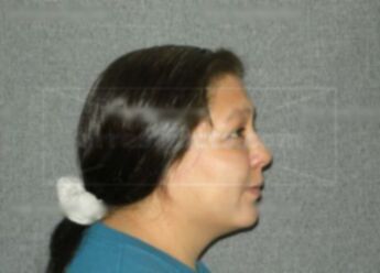Darlene J Simmons