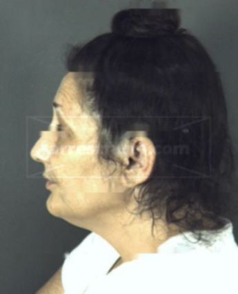 Nancy Lee Lewis
