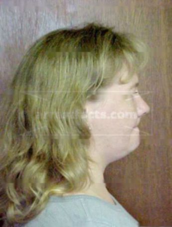 Sherri L Dills