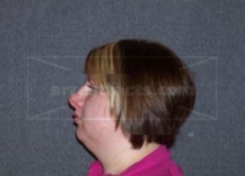 Brooke M Schindler