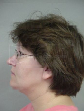 Shirley A Lessard