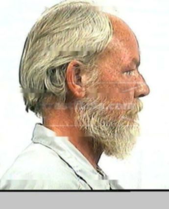 Harold D Hardesty
