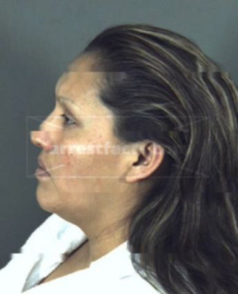 Ana Maria Medina-Ramirez