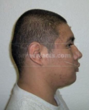 Anthony M Trejo