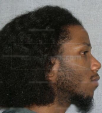 Alonzo D Armistead