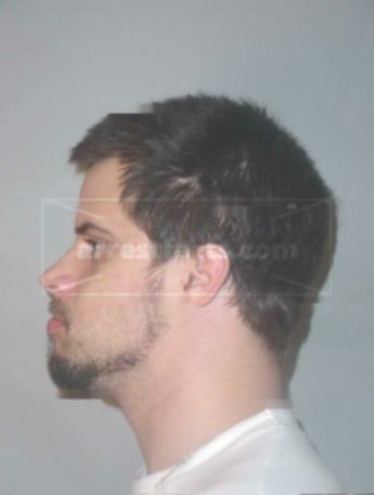 Matthew R Landwehr