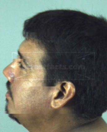 Jose Antonio Gonzales