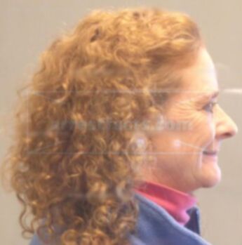 Doreen L Adcock