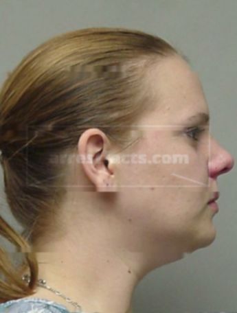 Nicole L Hunt