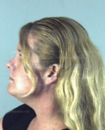 Lorie Ann Horn
