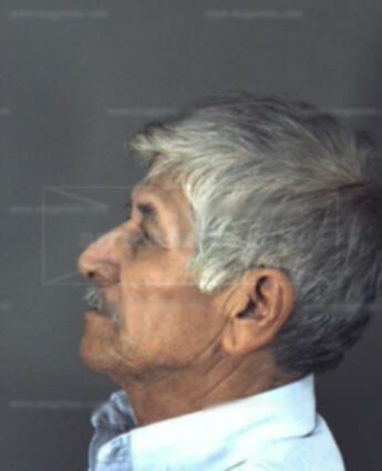 Alfredo Raya Gurerro