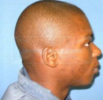 Andre D. Malone