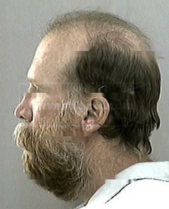 Robert M Brewer