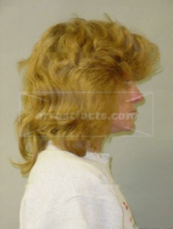 Vicki A Peters