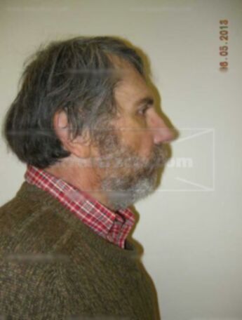 James D Dax