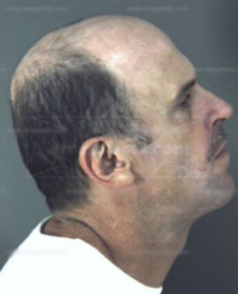 Dale Len Billings