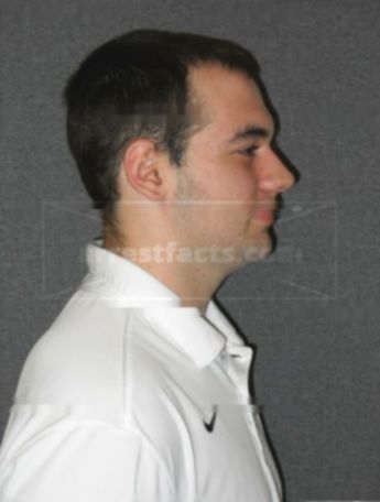 Matthew J Bralick
