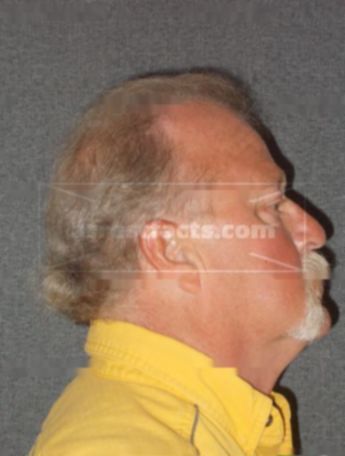 Lyle D Downing