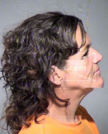 Lorrie Lynn Botkin