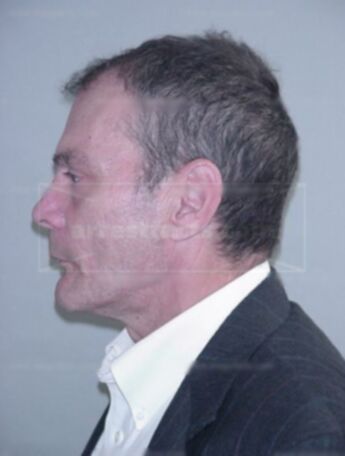 Richard Kovac
