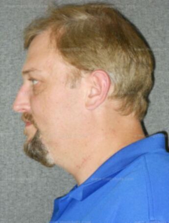 Robert A Hinzpeter