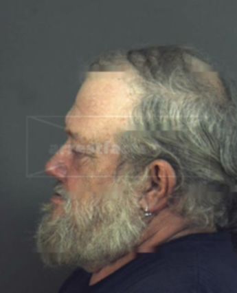 Dale Edward Montz
