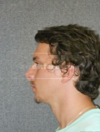 Jon H Jacobson