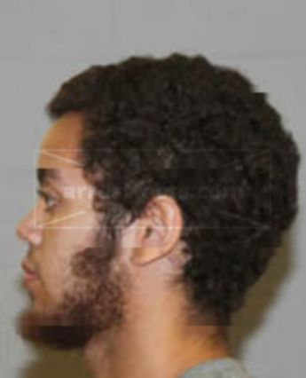Shiaba Marcus Allen