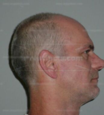 Brian A Jacobus