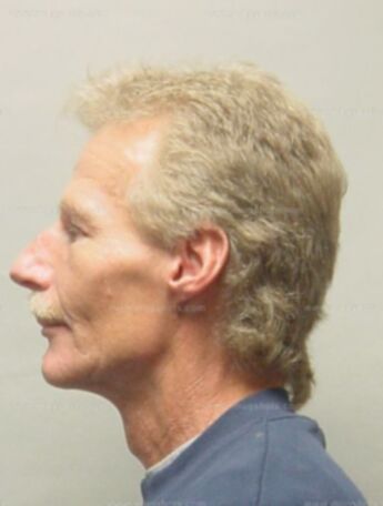Rickey D Christophersen