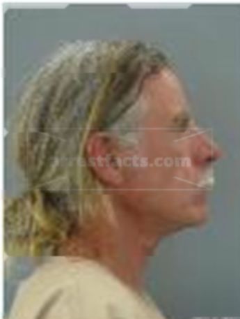 Terry Lee Fontanyi