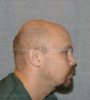 Christopher R Gish