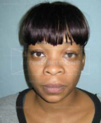 Antoinette L Smalls