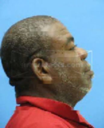 Morris A Saunders