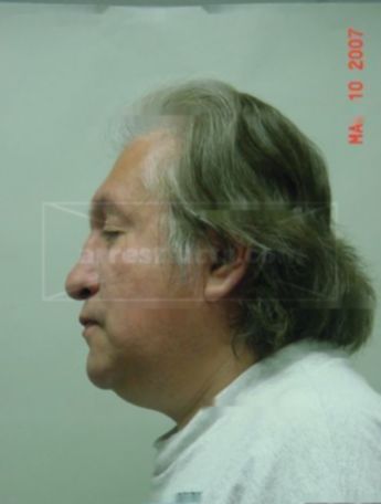 Gilbert J Blaker Jr.
