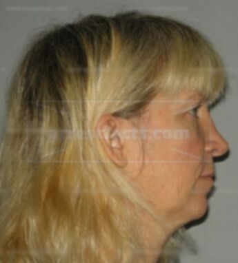Susanne M Burgaz