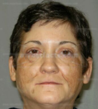 Christel R Jerome