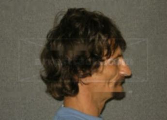 Woodrow J Barbee